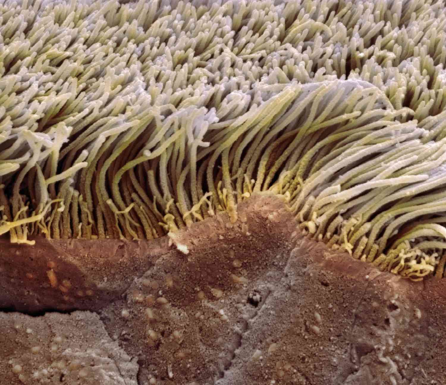 Fact Check: Are epithelial cells?