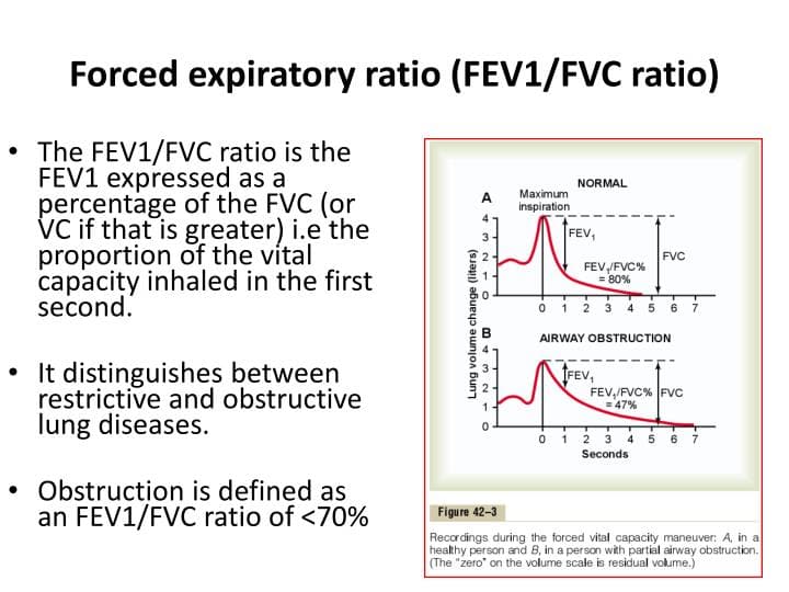 Fact Check: Are fvc and vc the same?