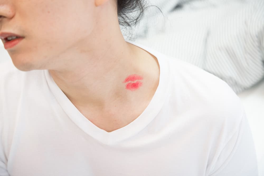 Fact Check: Are hickeys bad?