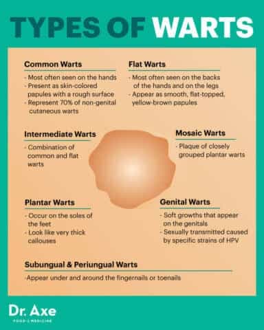 Fact Check: Are hpv warts painful?