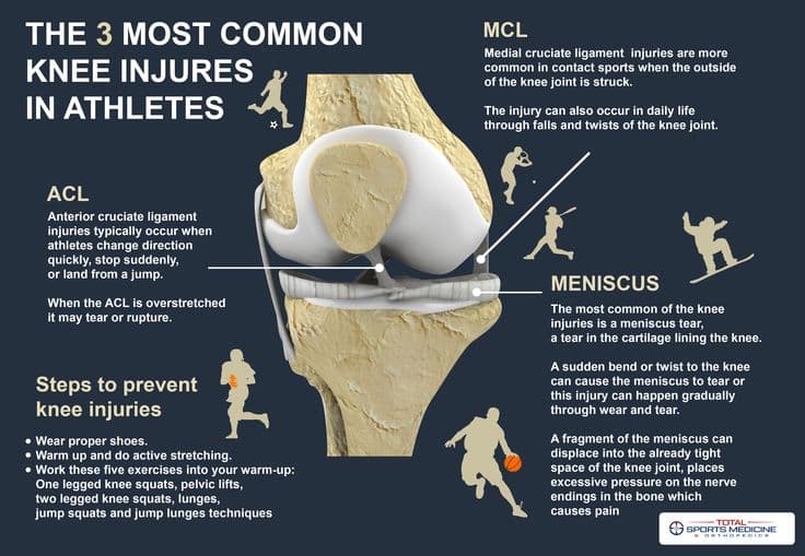 Fact Check: Are knee injuries common?