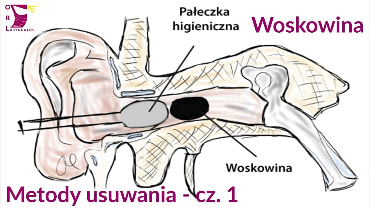 Fact Check: czy wosk od uszu działa?
