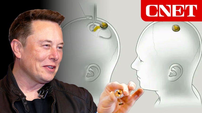 Fact Check: is Elon Musk losing his mind?
