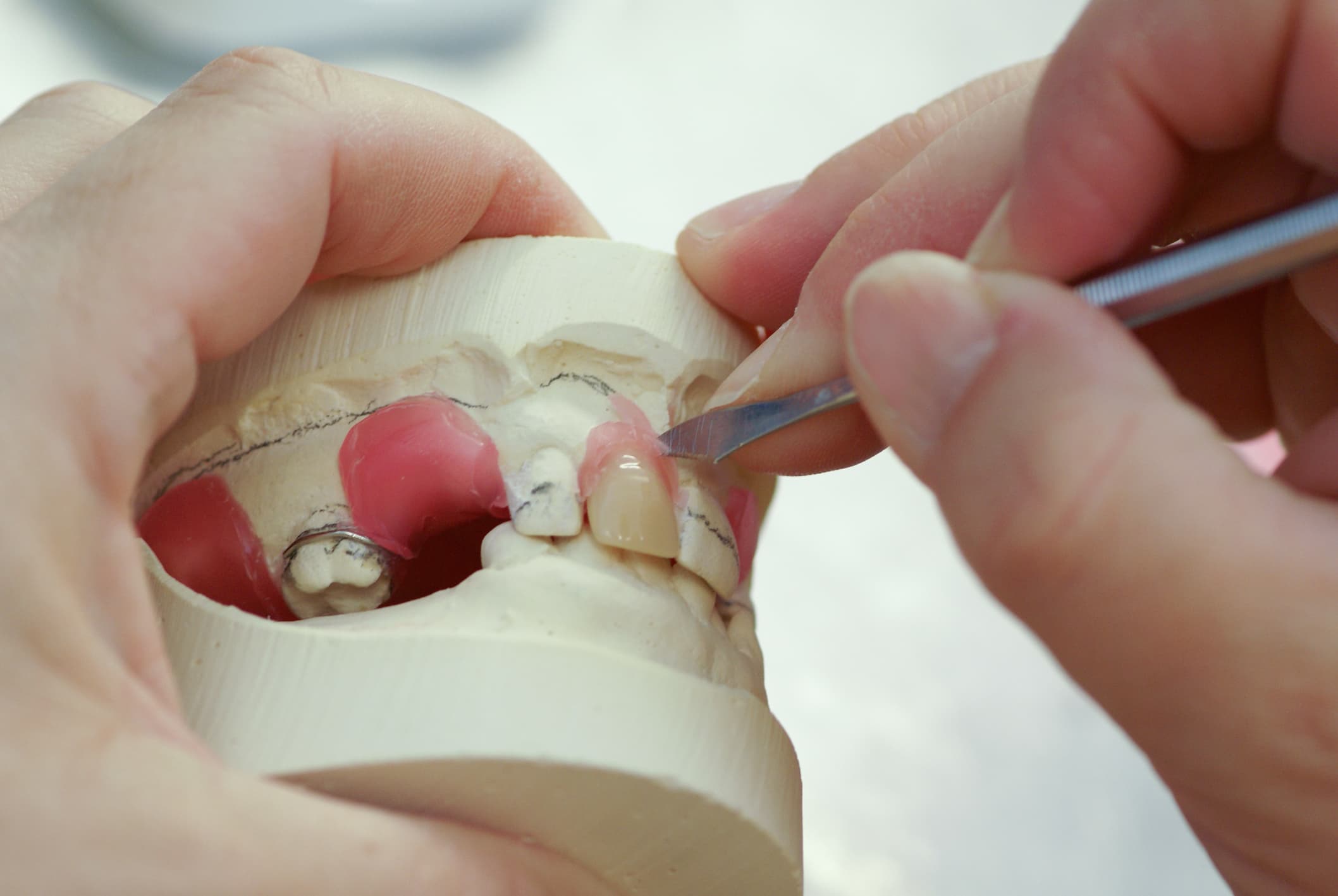 Fact Check: Are teeth bones?