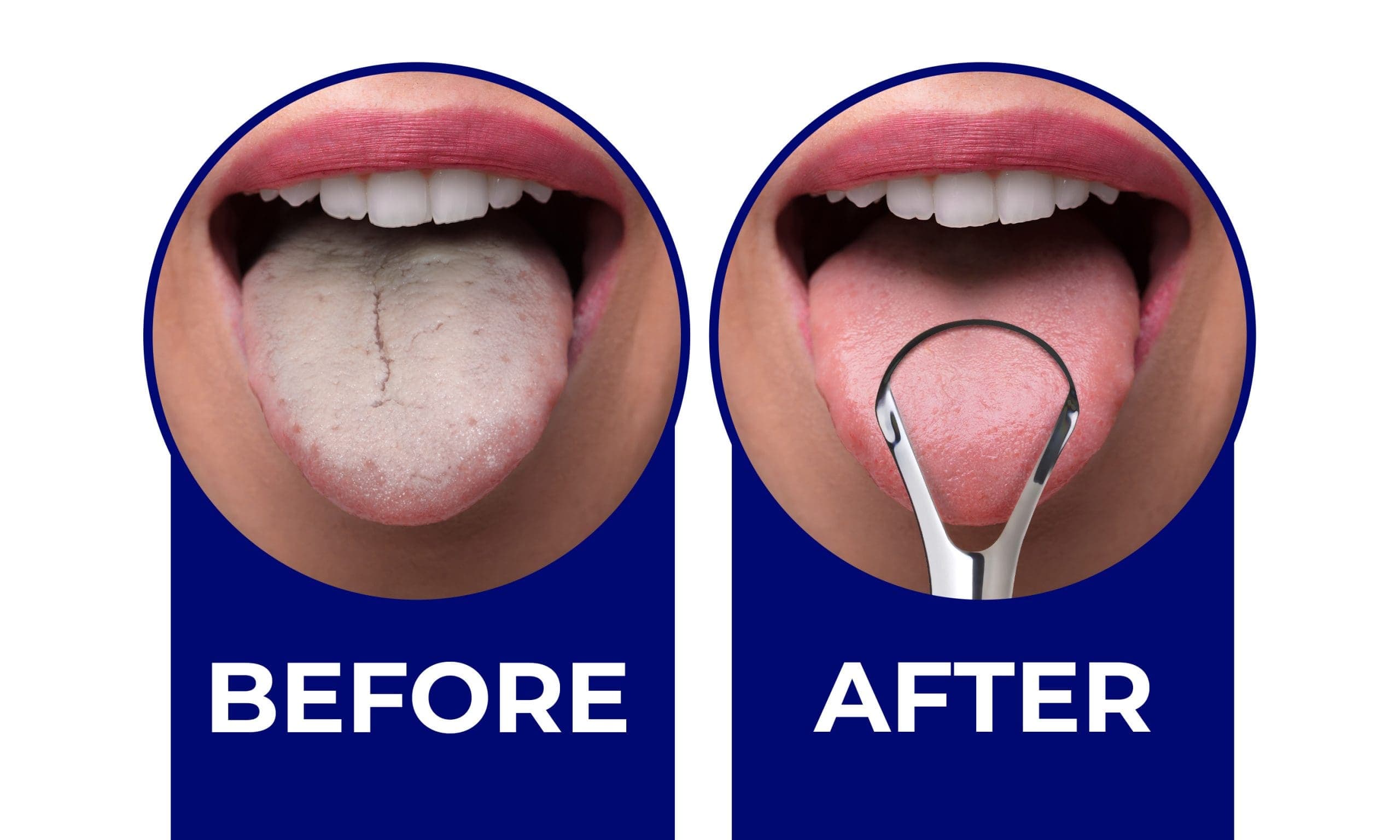 Fact Check: Are tongue scrapers good?