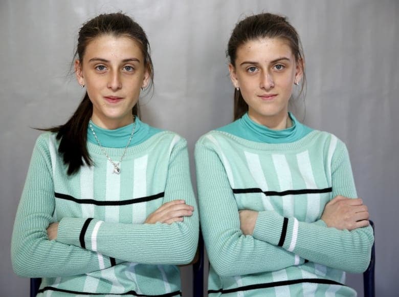 Fact Check: Are twins clones?
