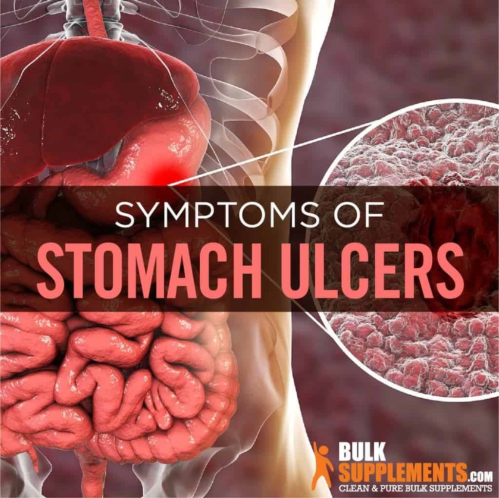 Fact Check: Are ulcers dangerous?