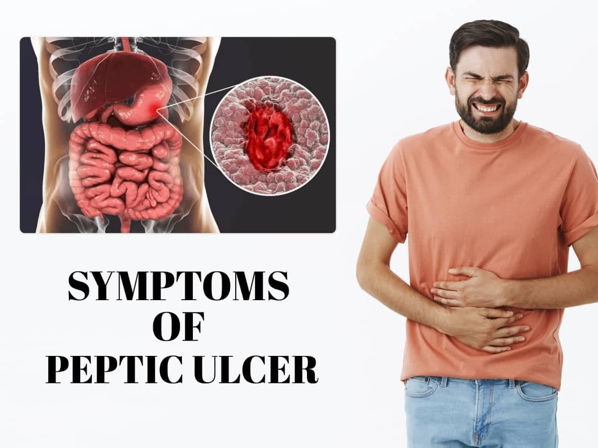 Fact Check: Are ulcers painful?