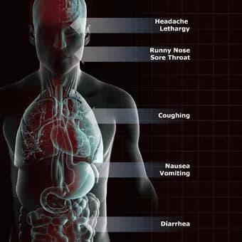 Fact Check: Are upper respiratory infections contagious?