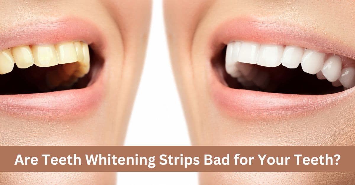 Fact Check: Are whitening strips bad for your teeth?