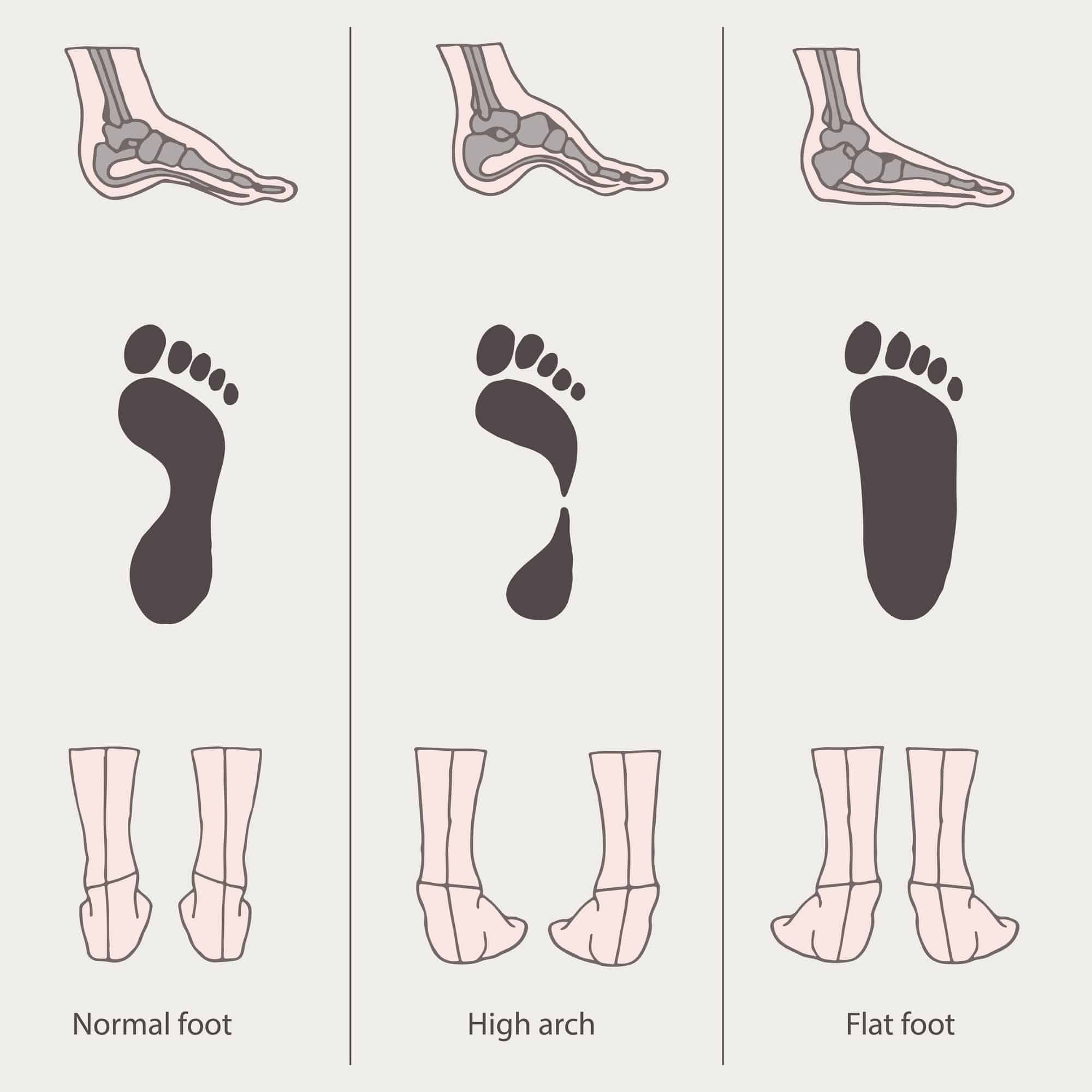 Fact Check: Are you low right footed?