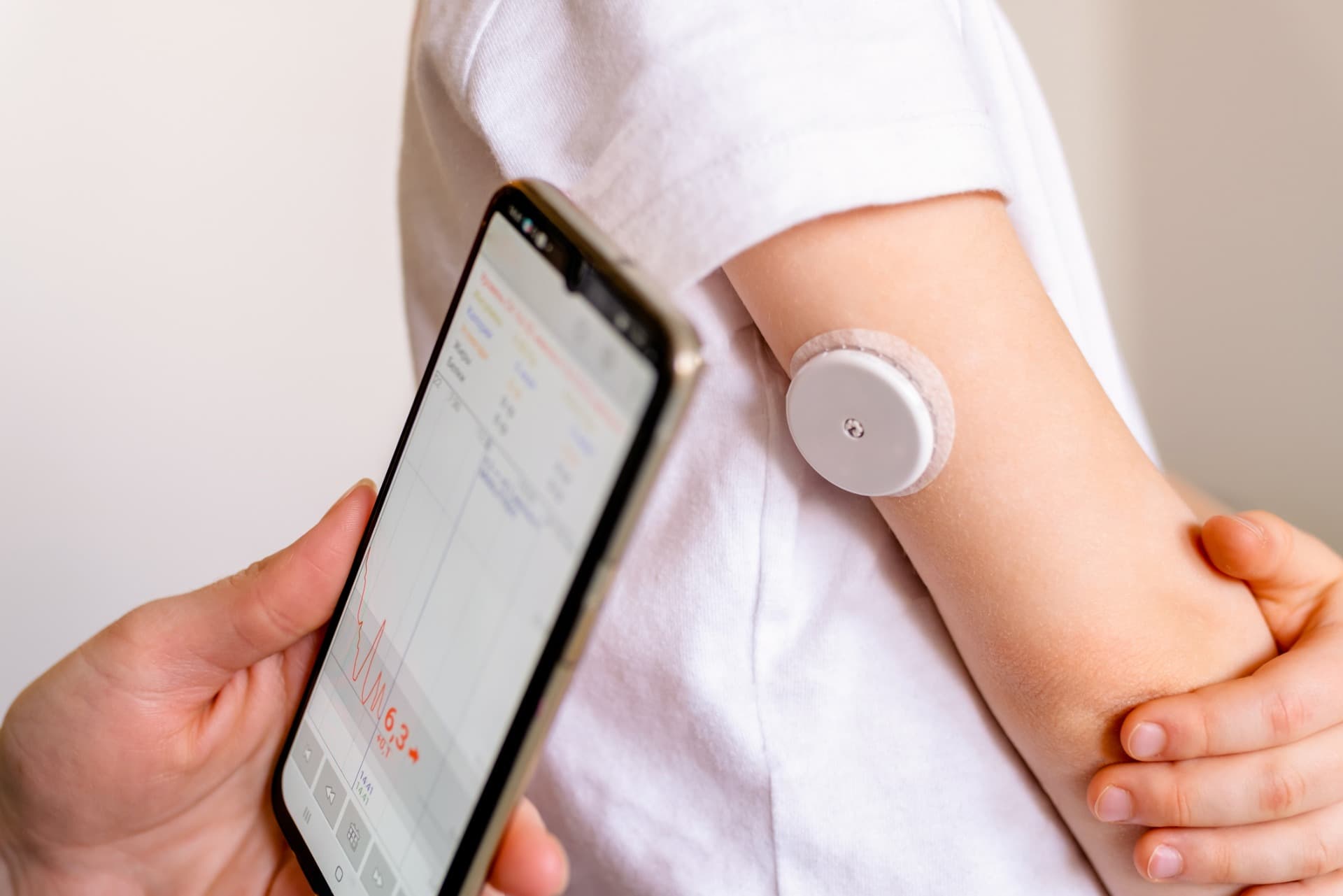 Fact Check: Is CGM approved?