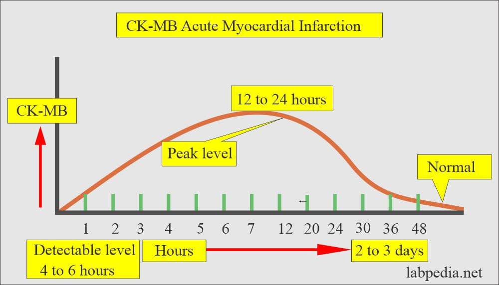 Fact Check: Is CK MB?