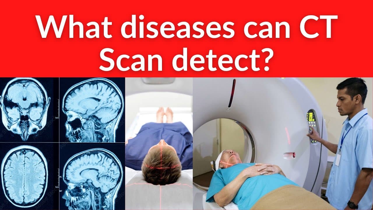 Fact Check: Is CT scan harmful?