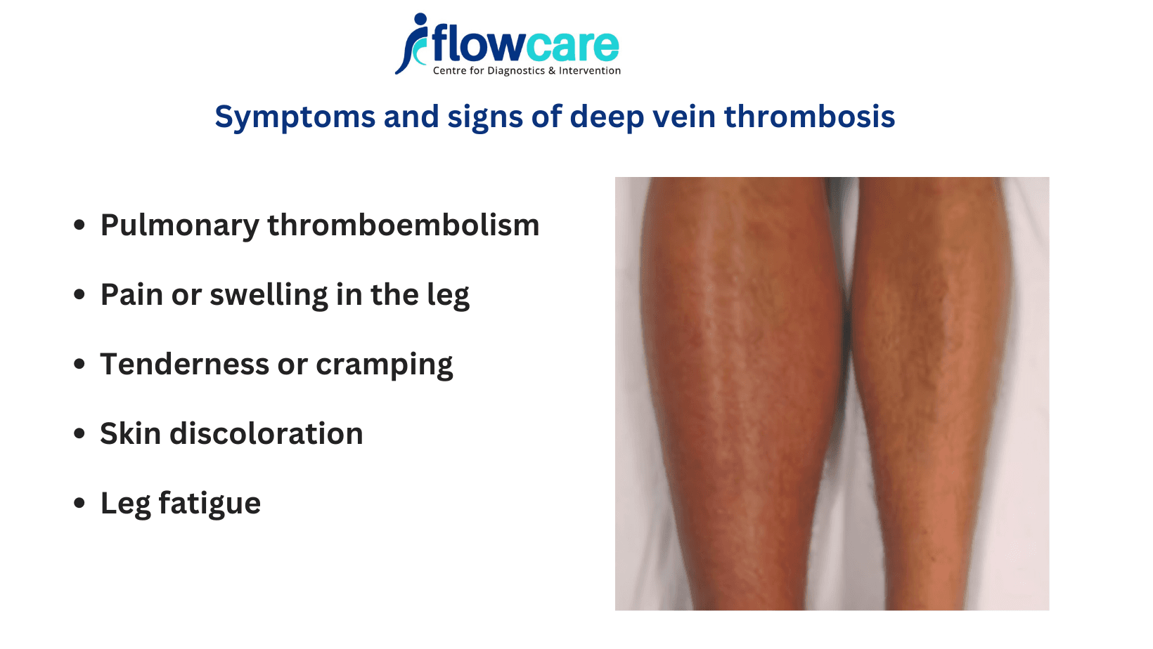 Fact Check: Is DVT pain constant?