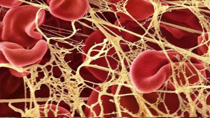Fact Check: Embalmers finding fibrous clothing in blood