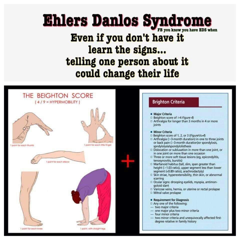 Fact Check: Is Ehlers Danlos a disability?