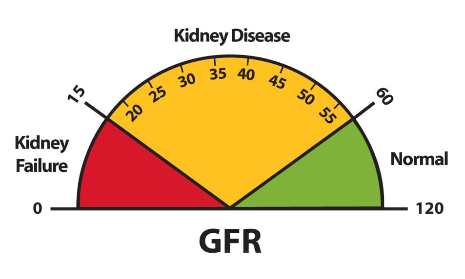 Fact Check: Is GFR a blood test?