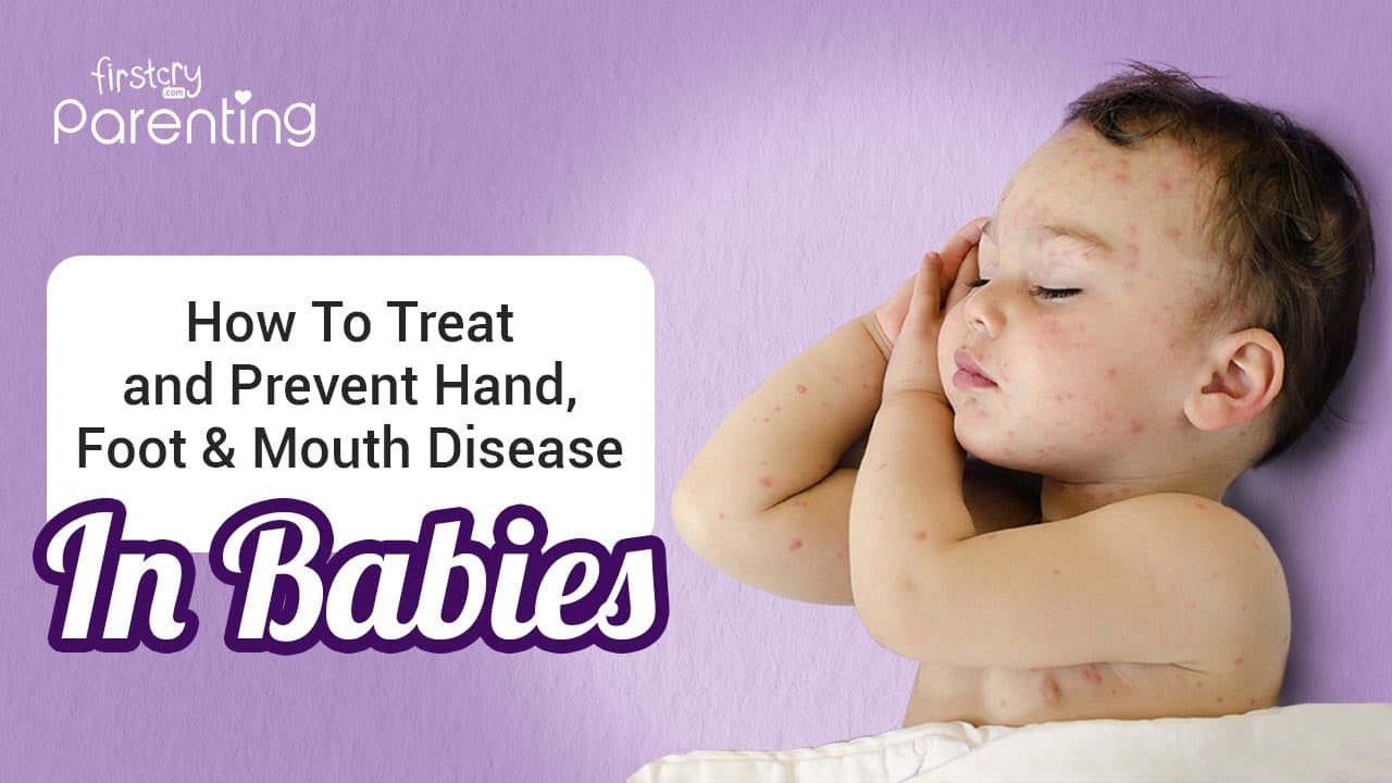 Fact Check: Is HFMD contagious?