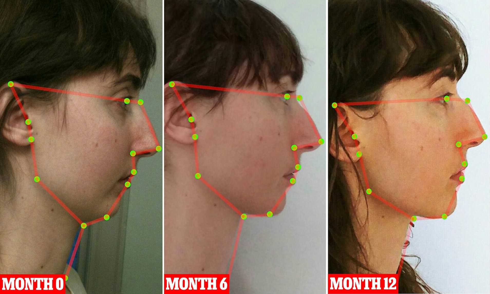 Fact Check: Transgender mouth 