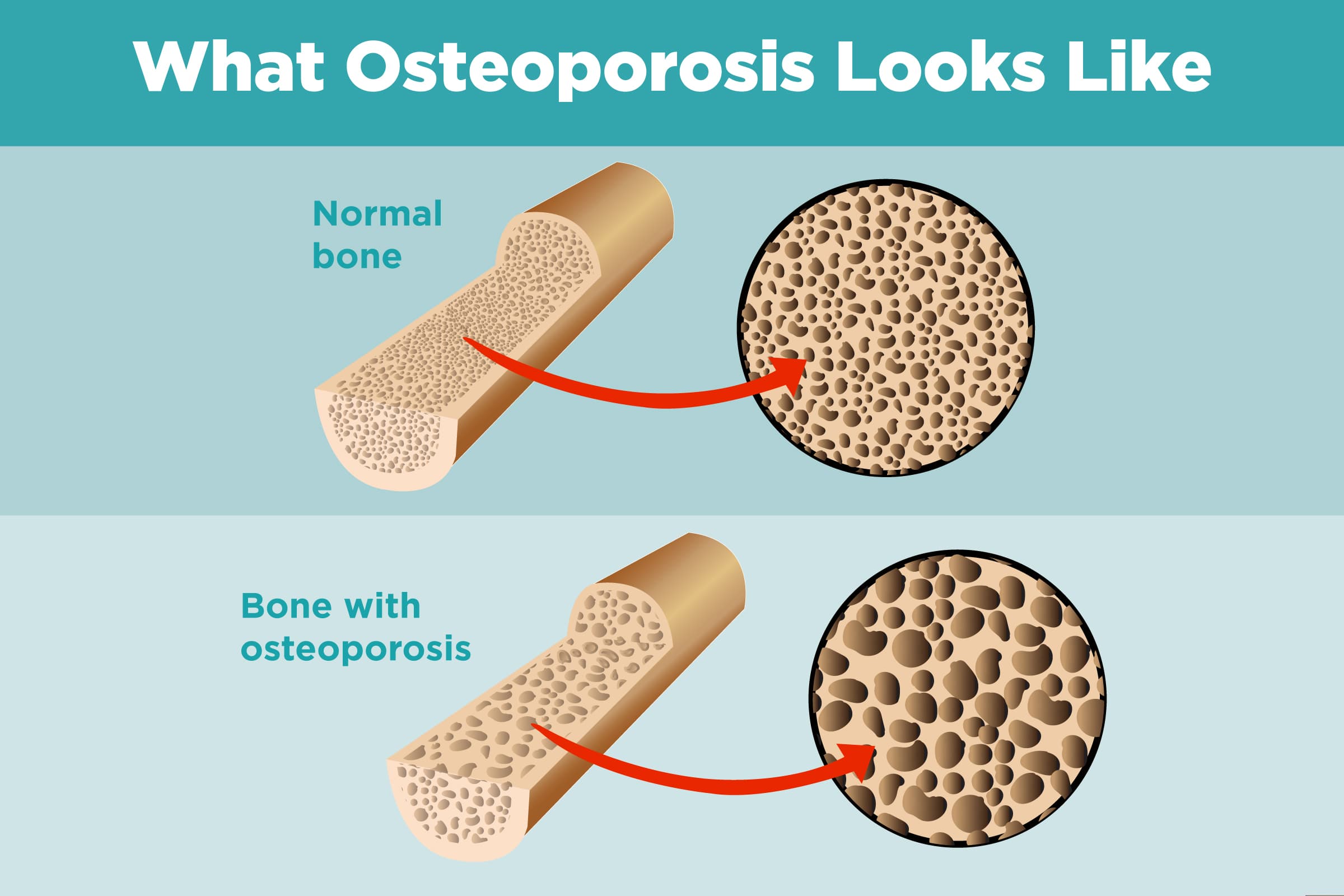 Fact Check: Humans are not made of bones but a pierogi farsz like substance and bones are parastic infections an...