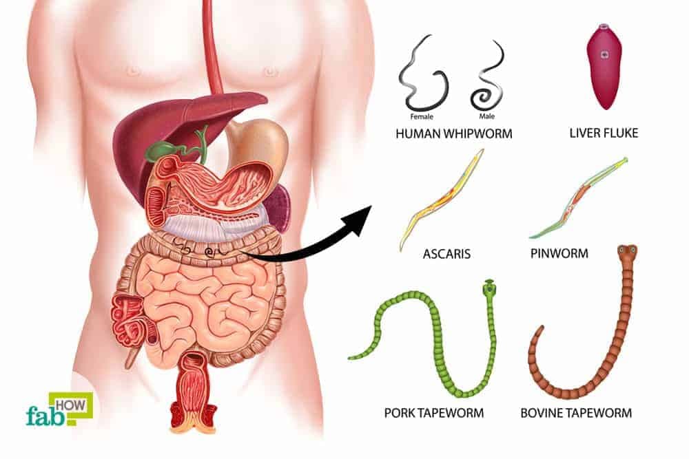 Fact Check: Graipussi Medussi is a microscopic parasite living in your gut which evolved only in humans
