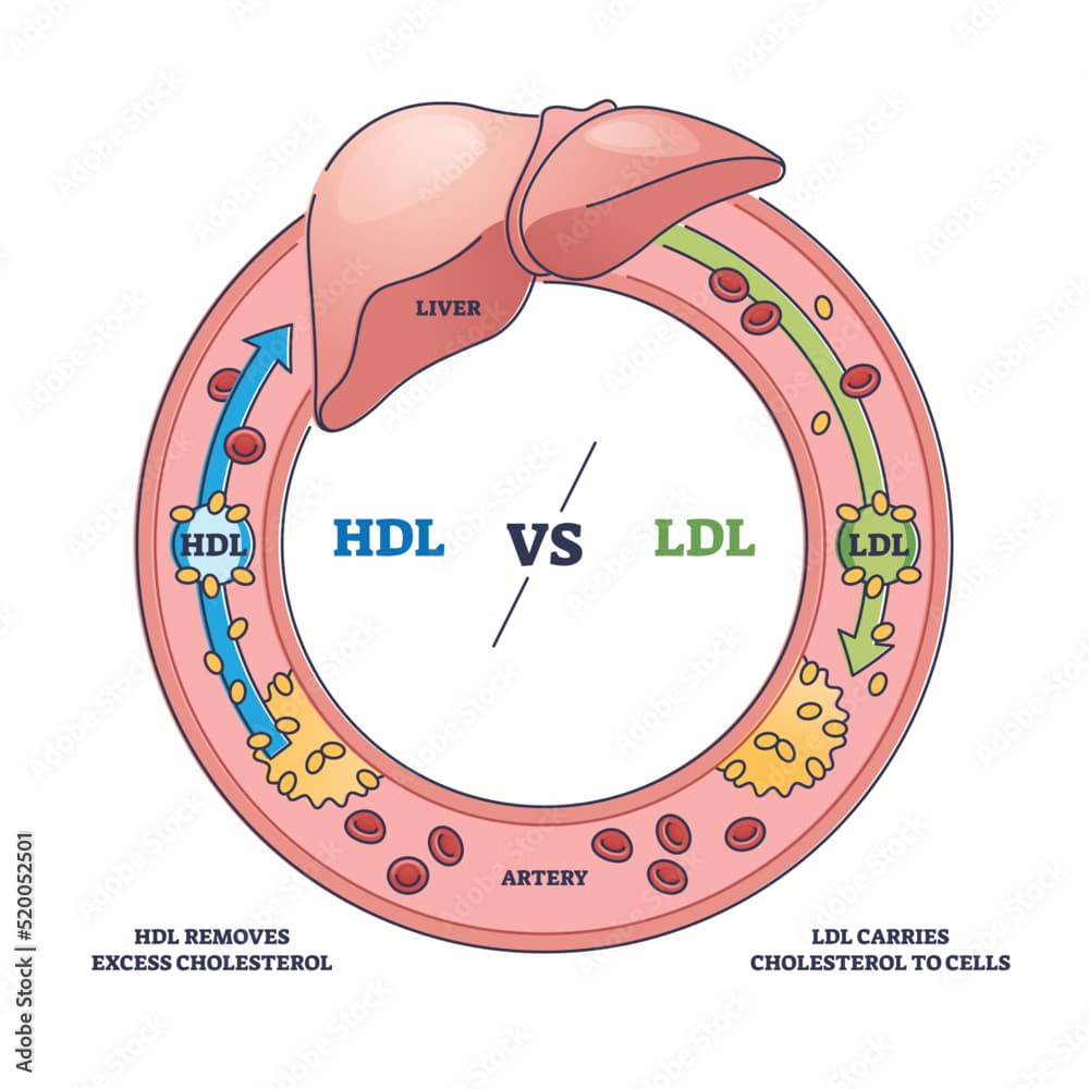 Fact Check: Is LDL bad cholesterol?