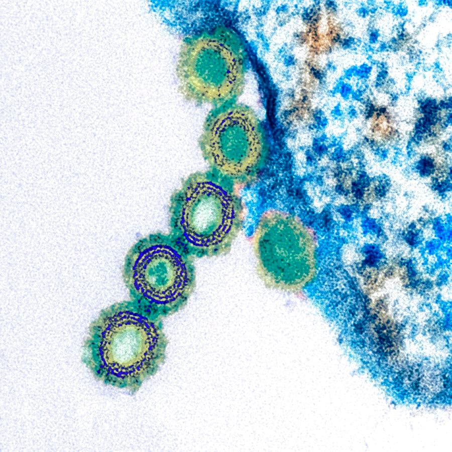 Fact Check: Tam has handled several public health crises including SARS in 2003, H1N1 swine flu in 2009, and mpox.