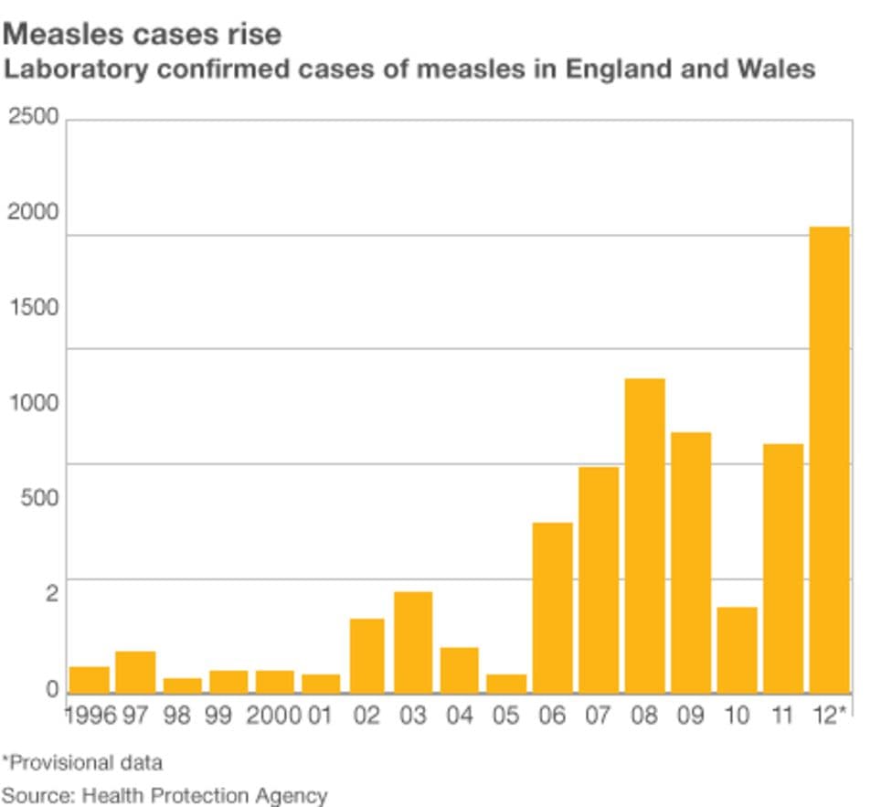 Fact Check: As of June 12, 2023, Alberta has reported 868 lab-confirmed cases of measles, with 134 confirmed cases as of noon on that date and 22 of those in the past 24 hours.