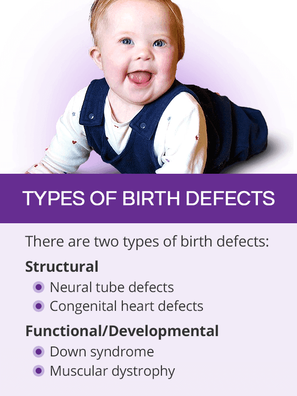 Fact Check: 1 in 33 babies in the U.S. are born with birth defects.