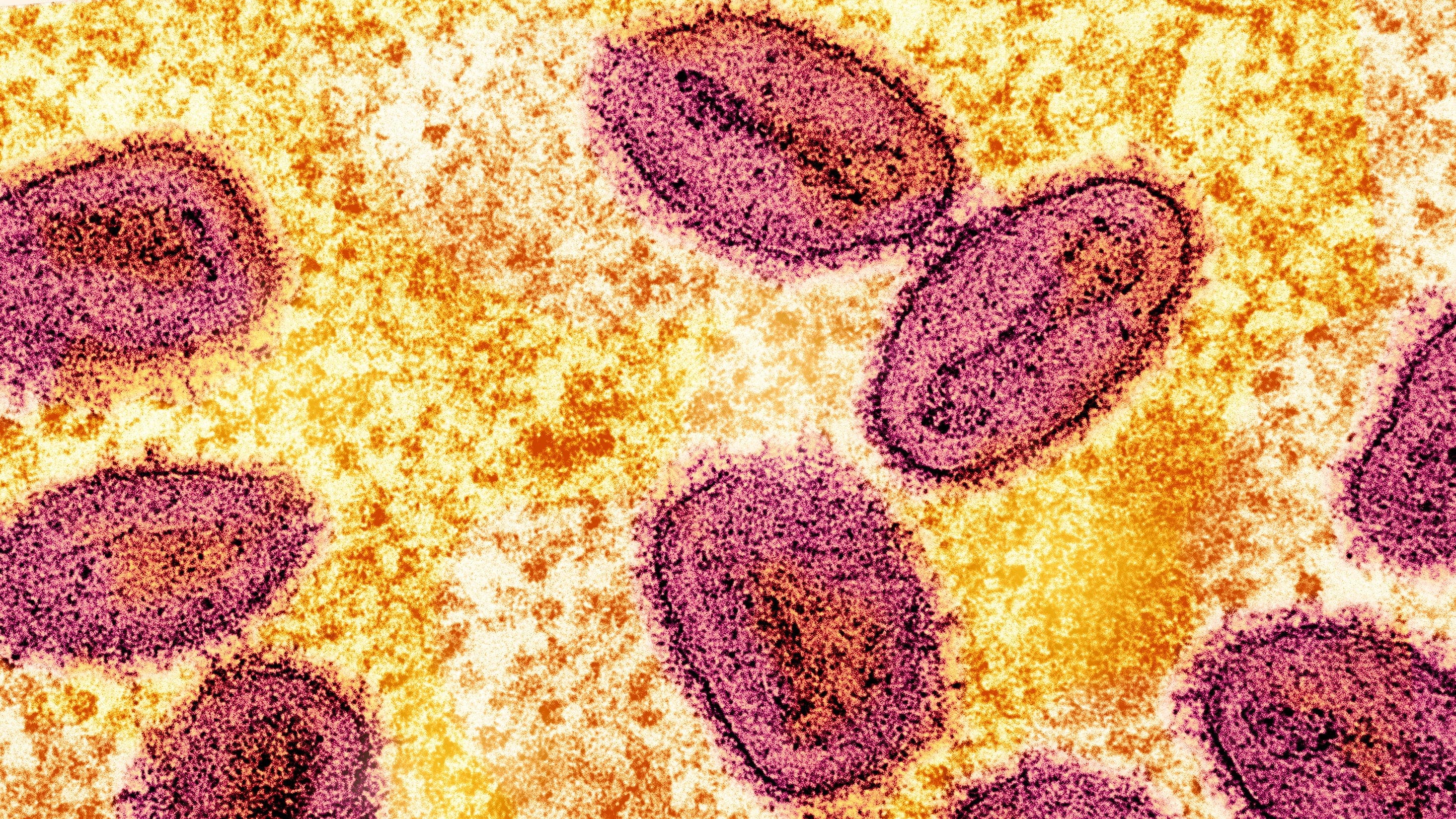 Fact Check: US health officials fear chaos will lead to increased sickness.