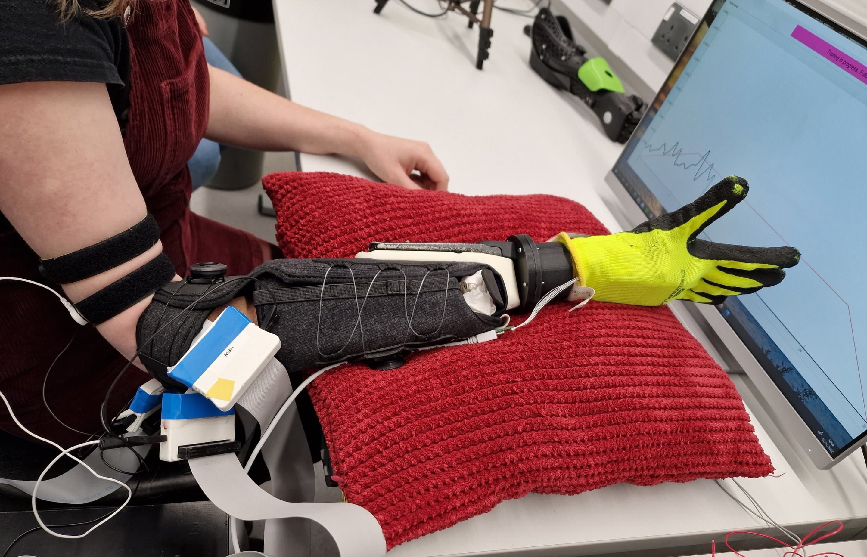 Fact Check: Prosthetic limb production surged 53% in 2024 due to war injuries.