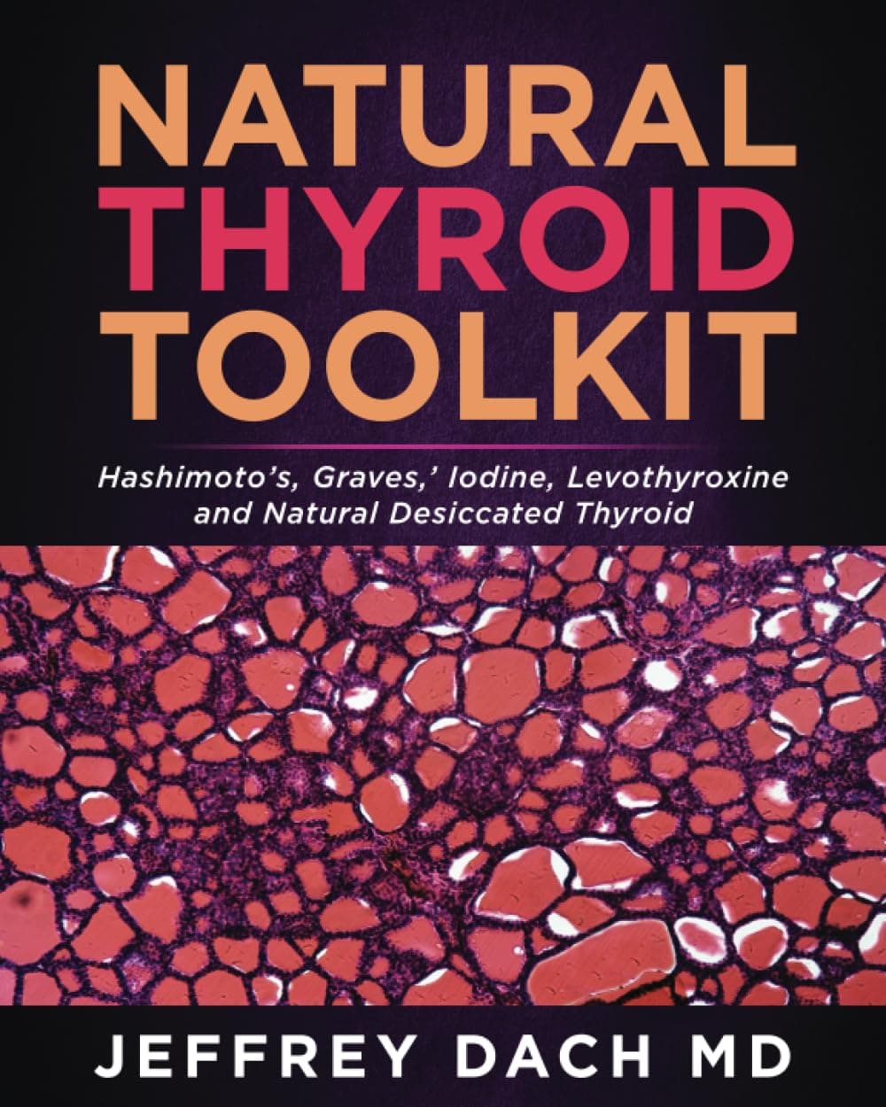 Fact Check: natural desiccated thyroid improves the health of those patients who have no thyroid gland and who remain ill using levothyroxine, 