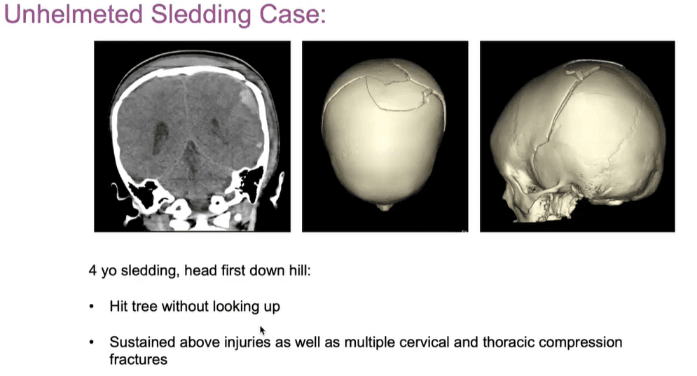 Fact Check: Child suffered severe skull fractures and spinal injuries after being thrown headfirst.