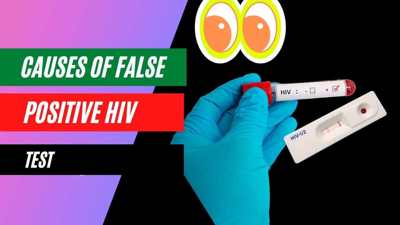 Fact Check: Is RVS test the same as HIV test?
