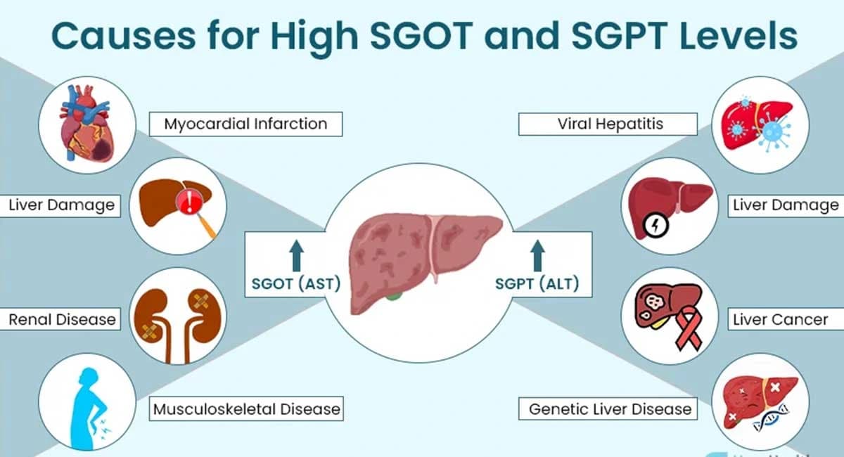 Fact Check: Is SGOT ALT?