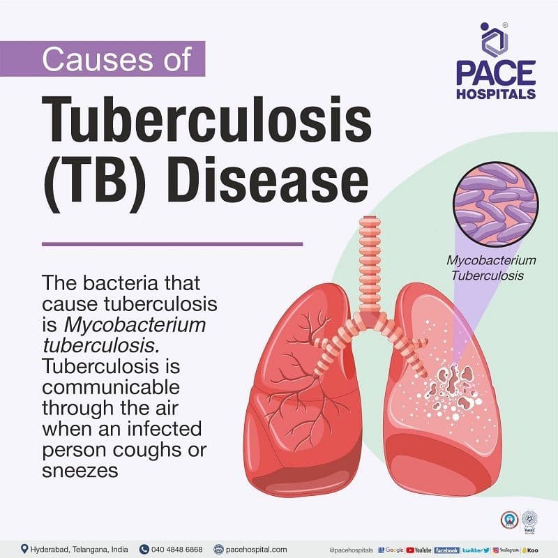 Fact Check: Is TB contagious?