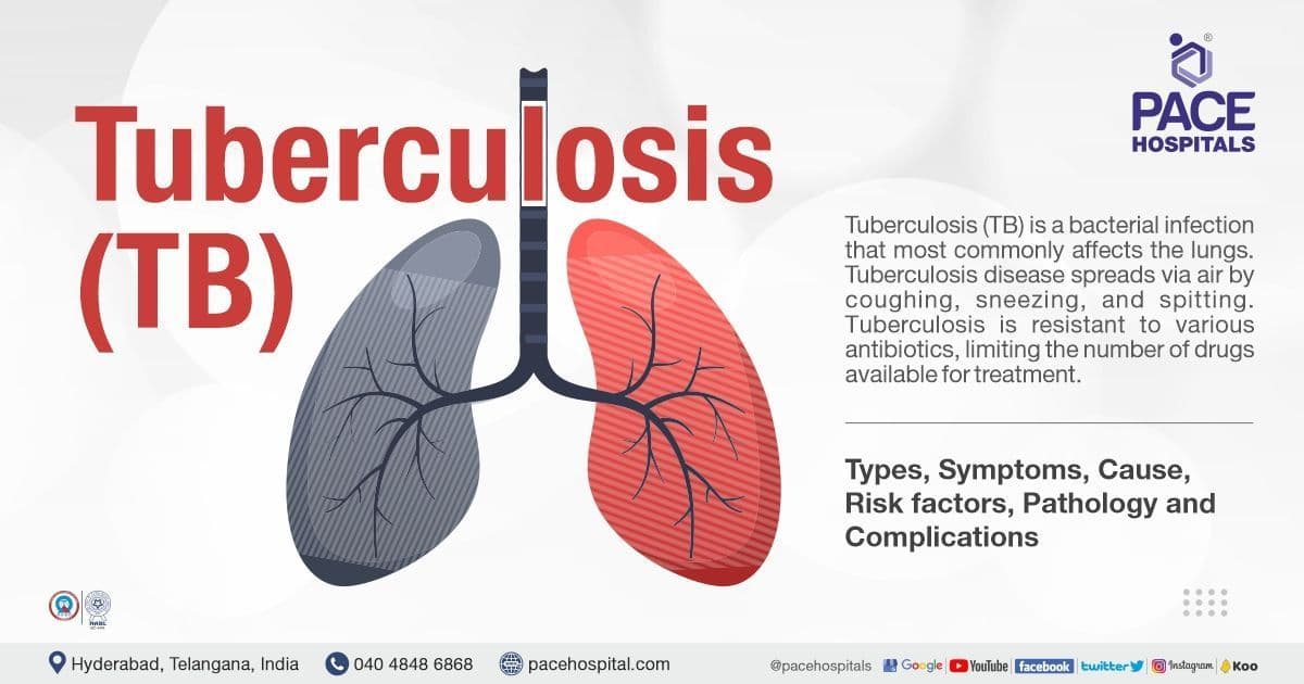 Fact Check: Is TB curable?