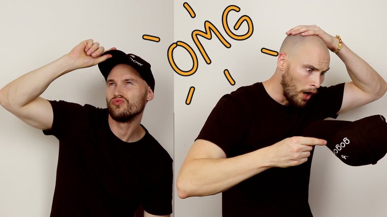 Fact Check: Wearing a hat makes you go bald