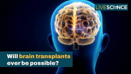 Fact Check: Is brain transplants possible?