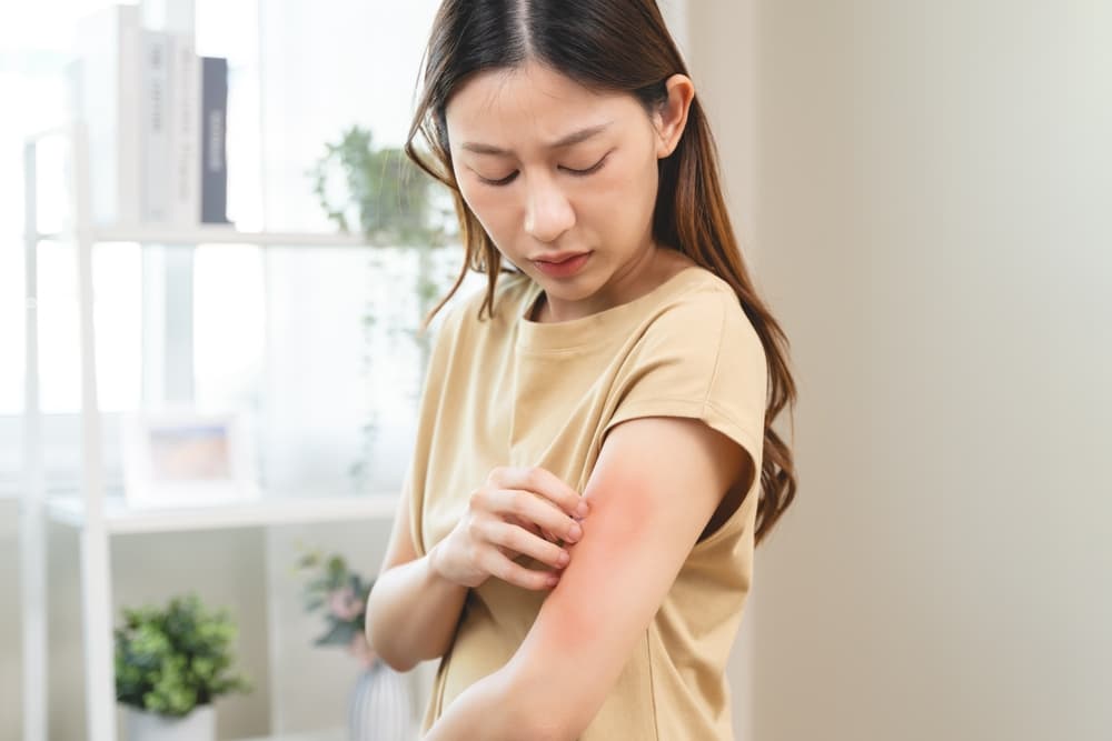 Fact Check: Is eczema contagious?