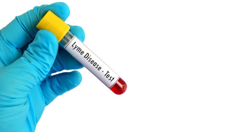 Fact Check: Is lyme disease curable?