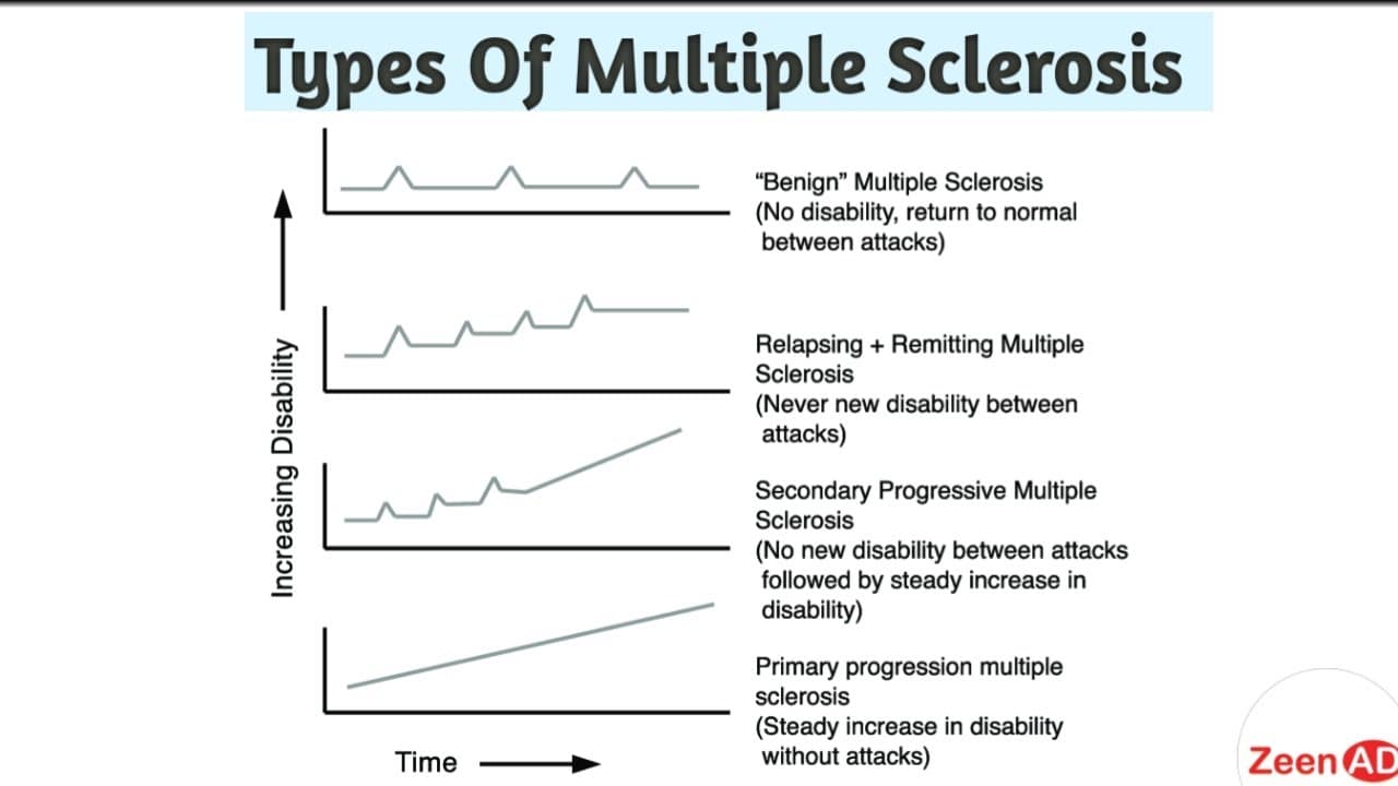 Fact Check: Is multiple sclerosis (MS) a genetic condition?