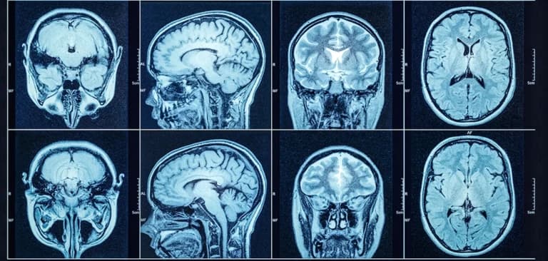 Fact Check: CT scans are used to visualize brain structures and diagnose conditions.
