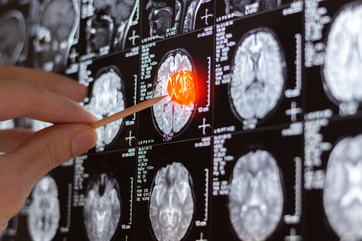 Fact Check: Medical imaging is crucial for diagnosing brain injuries and disorders.