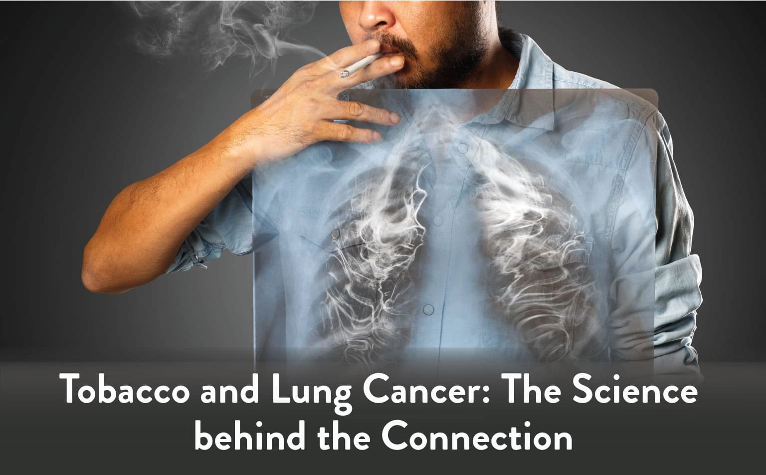 Fact Check: Smoking is a leading cause of lung cancer worldwide.