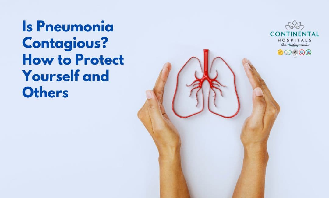 Fact Check: Is pneumonia contagious?
