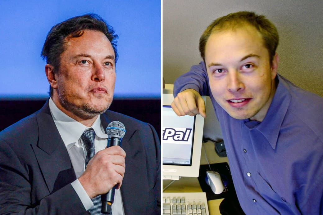 Fact Check: Does Elon musk have gynecomastia?
