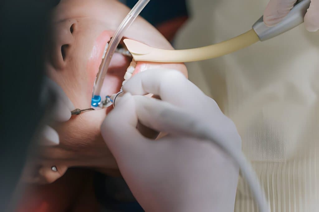 Fact Check: Is rct painful?