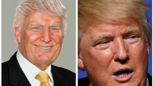 Fact Check: Donald Trump is already older than a man in his physical condition could expect to do